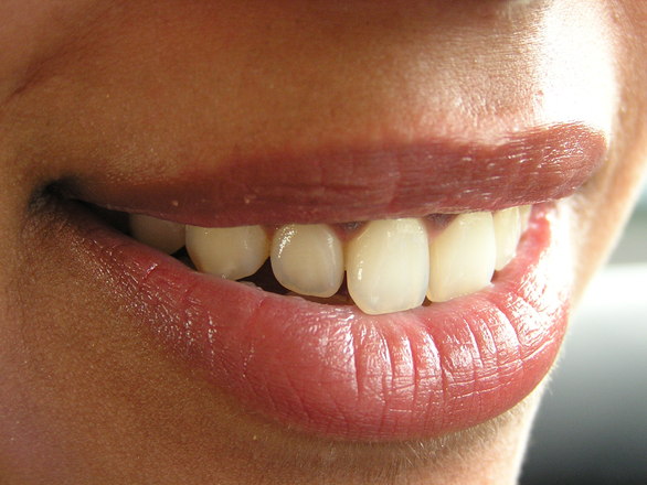 Dental Implants Delaware Ohio